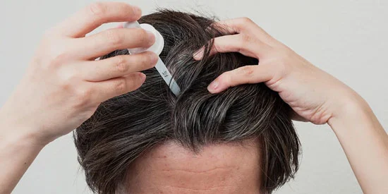 How to Use Minoxidil