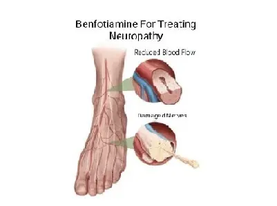 Benfotiamine