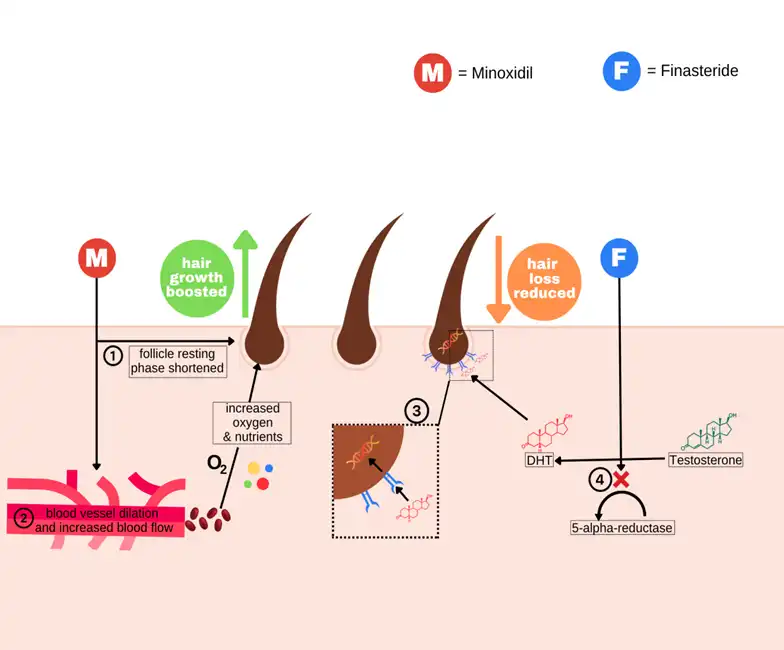 Minoxidil