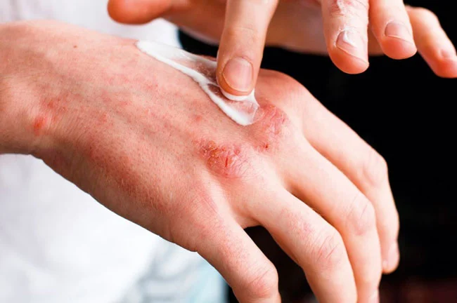 product-1-1 product-1-1