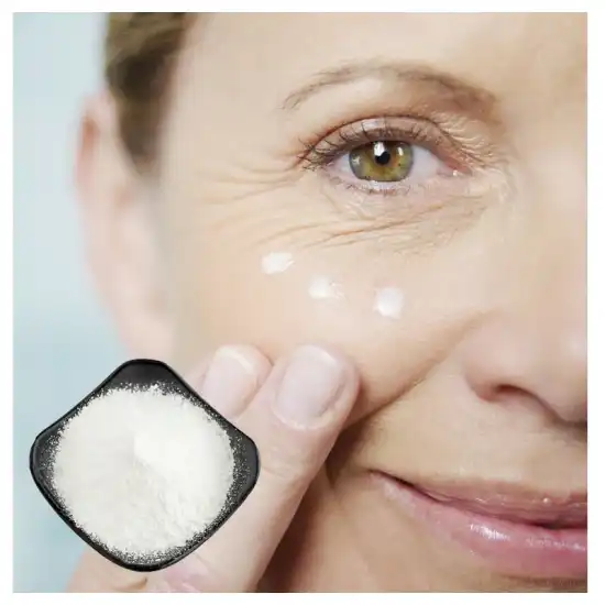 Monobenzone Monobenzone